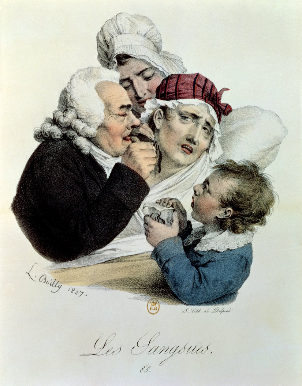 Sanguisughe, inciso da Delpech, 1827 da Julien Leopold Boilly