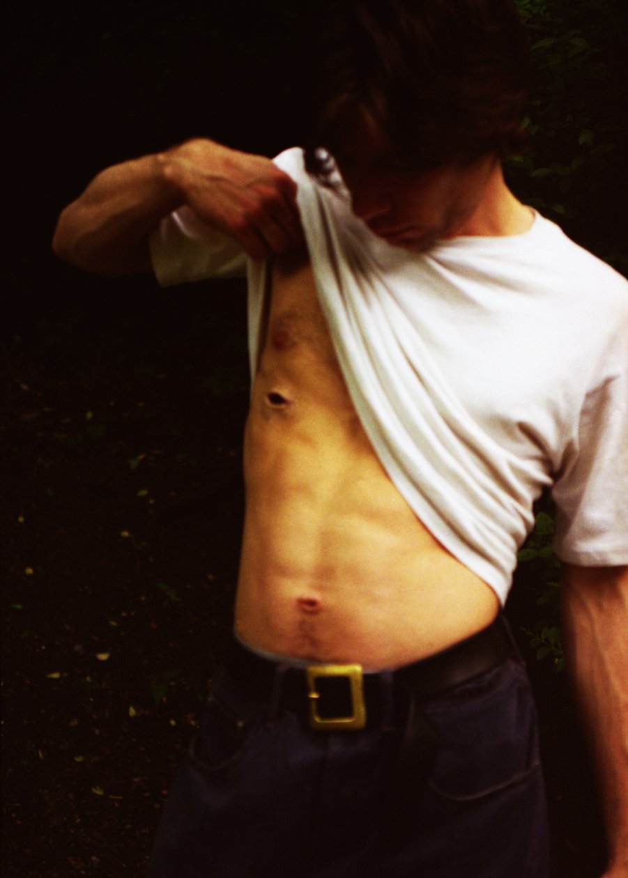 Ferita da Mat Collishaw
