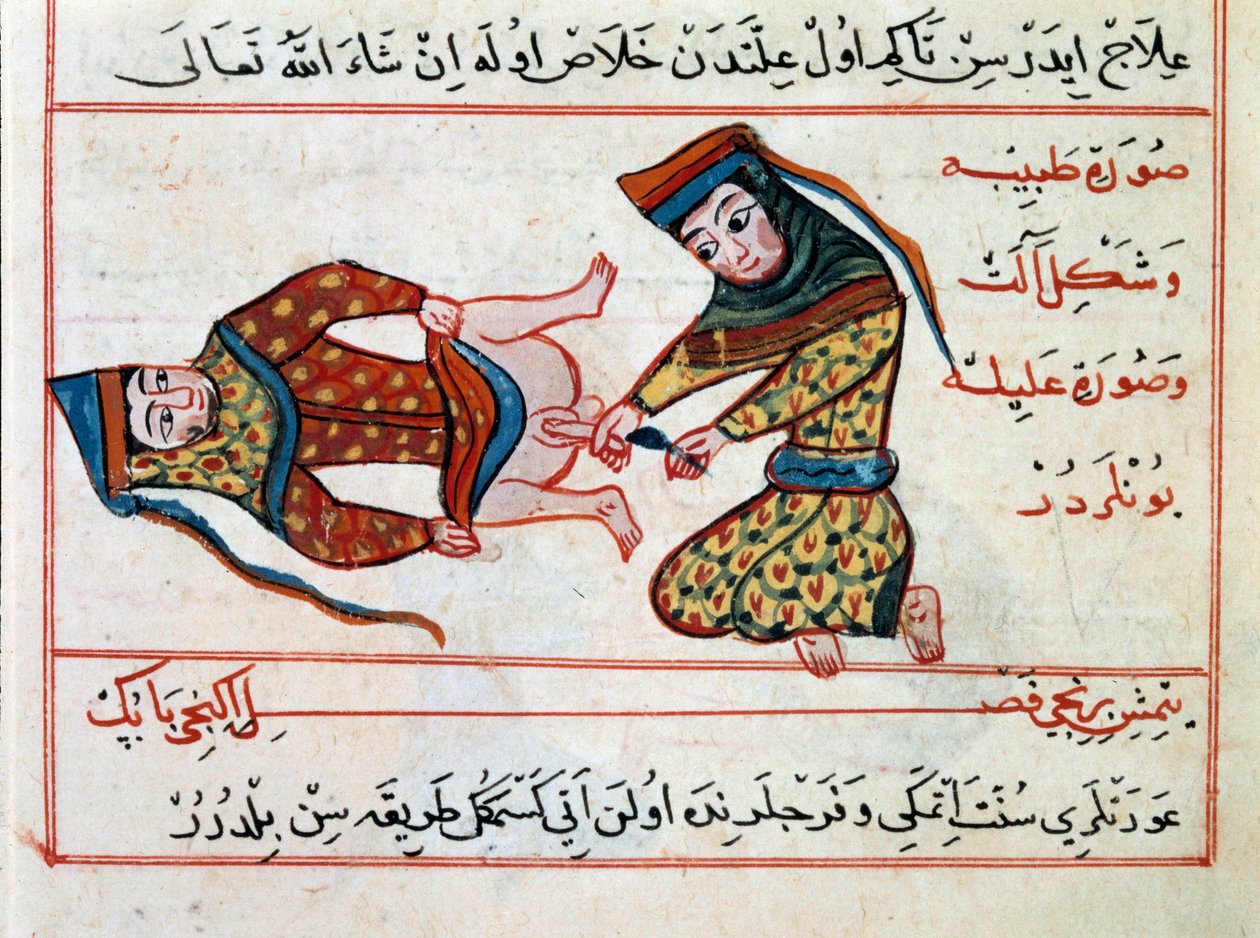 Operazione di un ermafrodita da Ottoman School