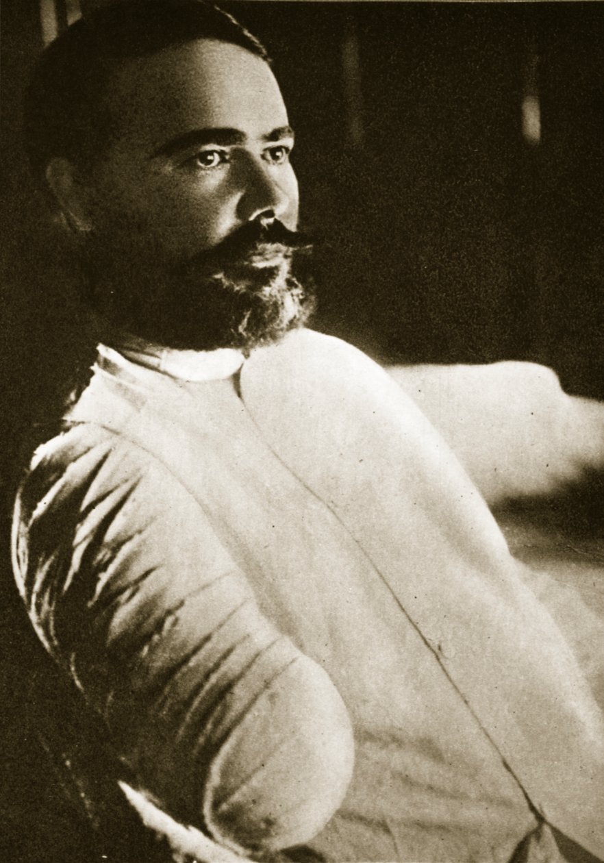 Il generale Obregon dopo che il suo braccio destro è stato fatto saltare da una granata a Santa Ana del Conde, 1915 da Paul Thompson