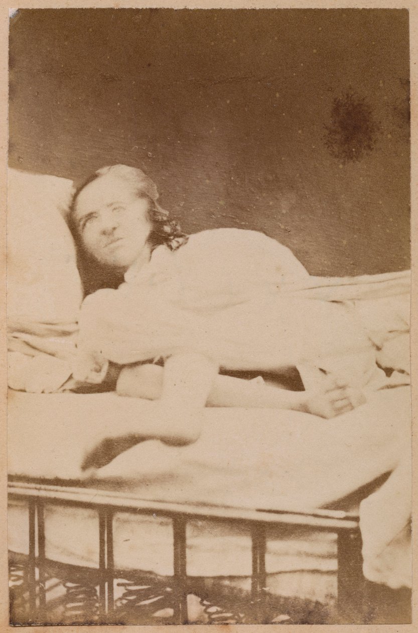 Epilessia isterica, contorsioni, tavola XXXVIII da 