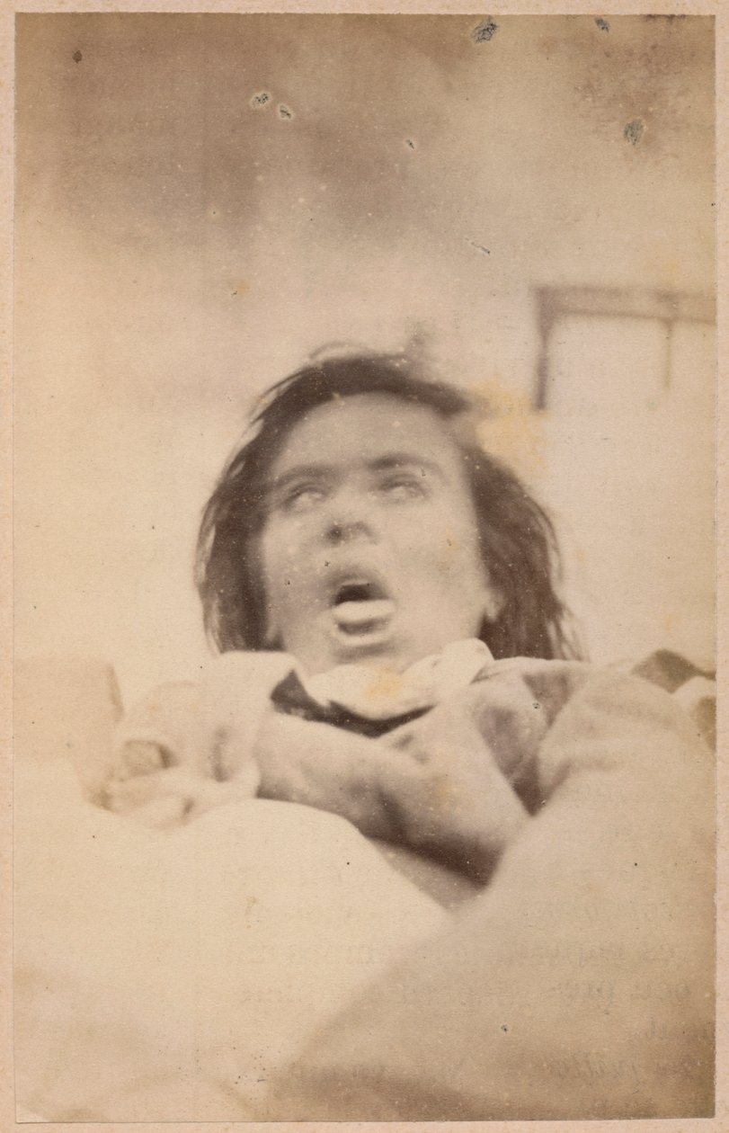 Epilepsia isterica, allucinazioni, angoscia, tavola XXIX da 