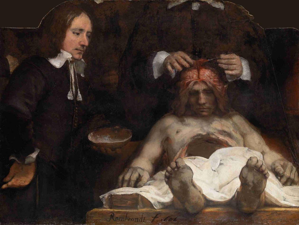 La lezione di anatomia del dottor Jan Deijman da Rembrandt van Rijn