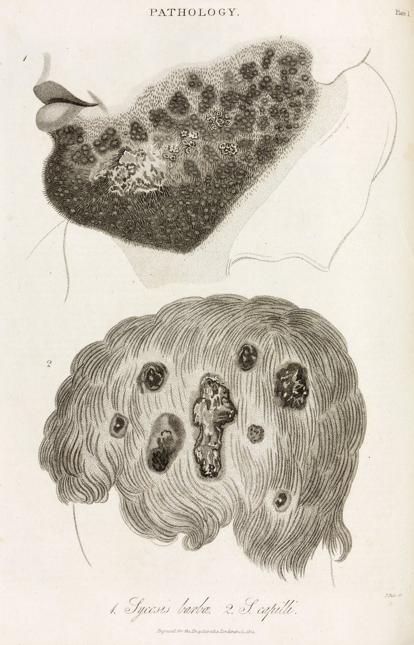Dermatologia Malattie della pelle da John Pardon