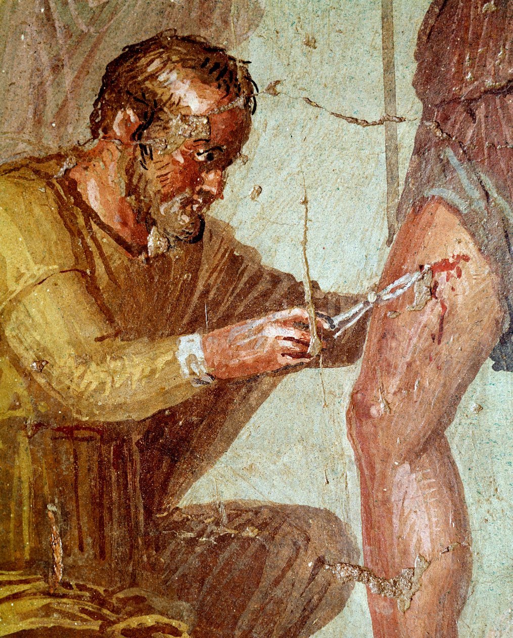 Enea ferito è curato da Iapige aiutato da Venere da Roman