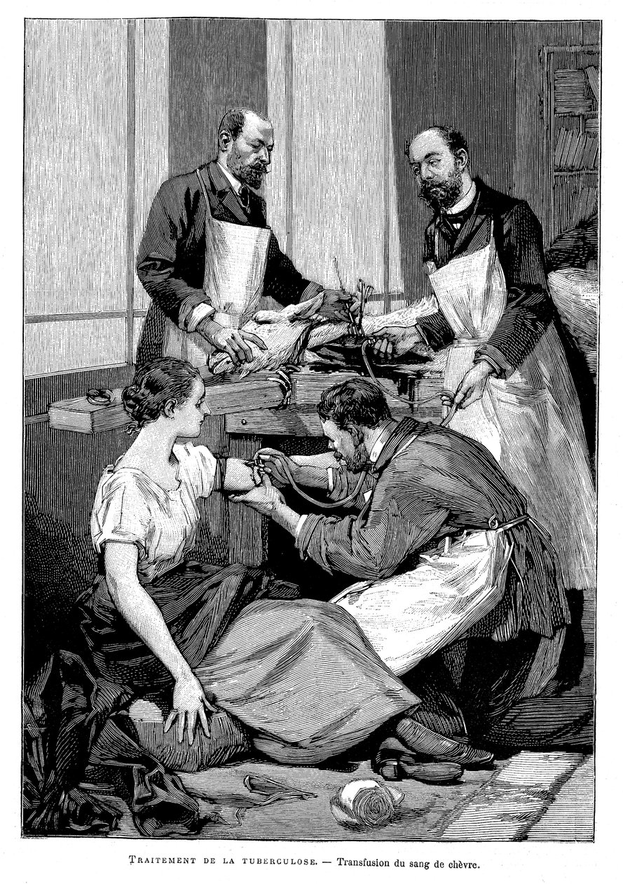 Un paziente tubercolotico che riceve una trasfusione di sangue di capra, 1891 da Unbekannt
