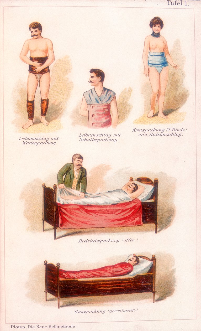 Trattamenti idroterapici, c1902 da Unbekannt