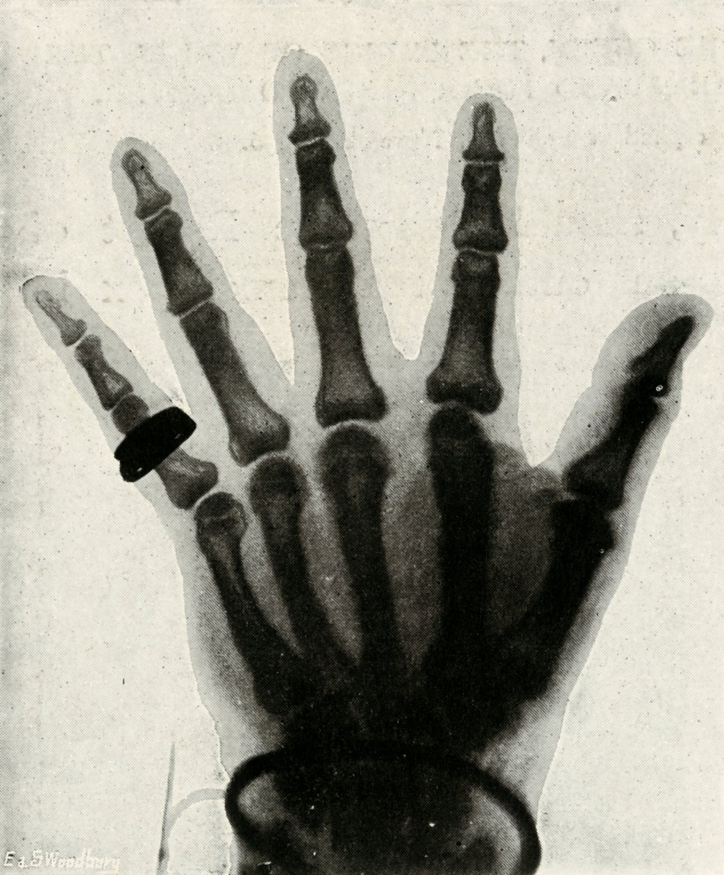 Radiografia della mano di S.A.R. Il Principe di Galles da Unbekannt