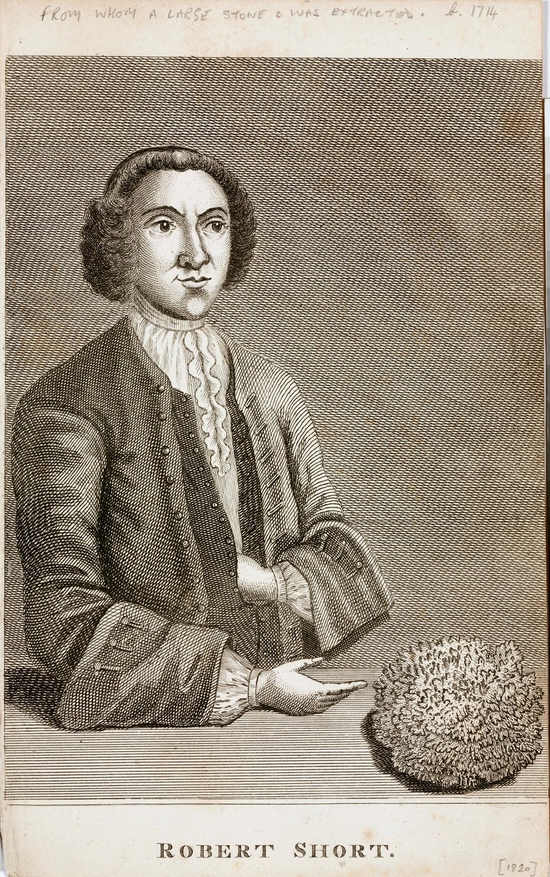 Robert Short, curiosità medica, c. 1750 da Unbekannt