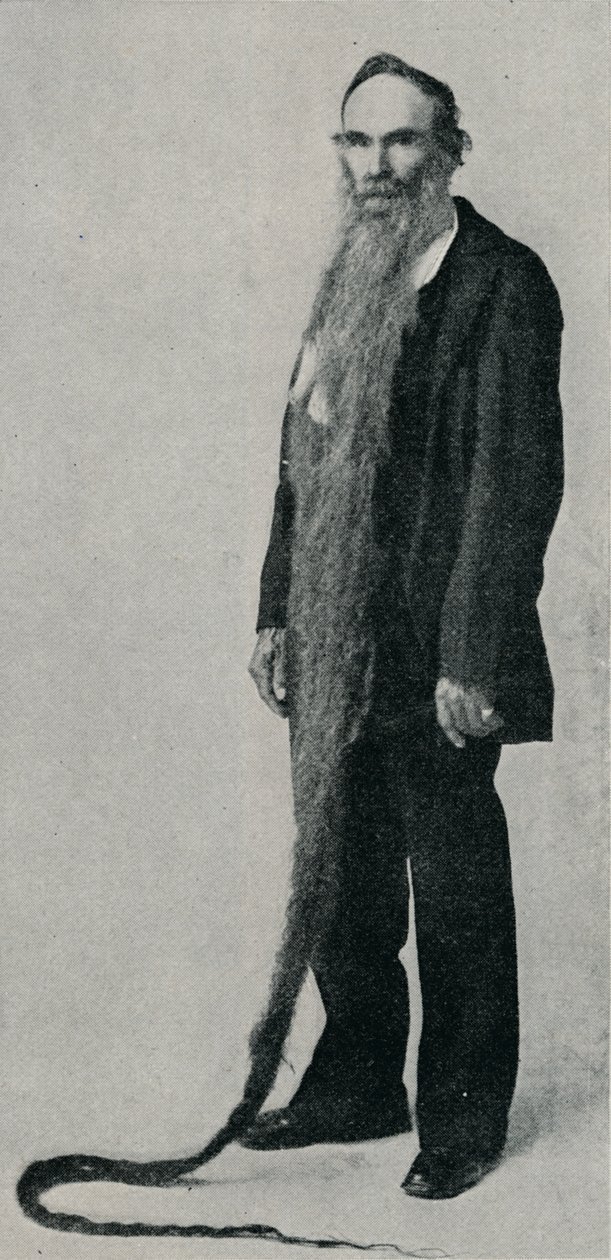 La barba più lunga mai registrata, 1896, 1910 da Unbekannt