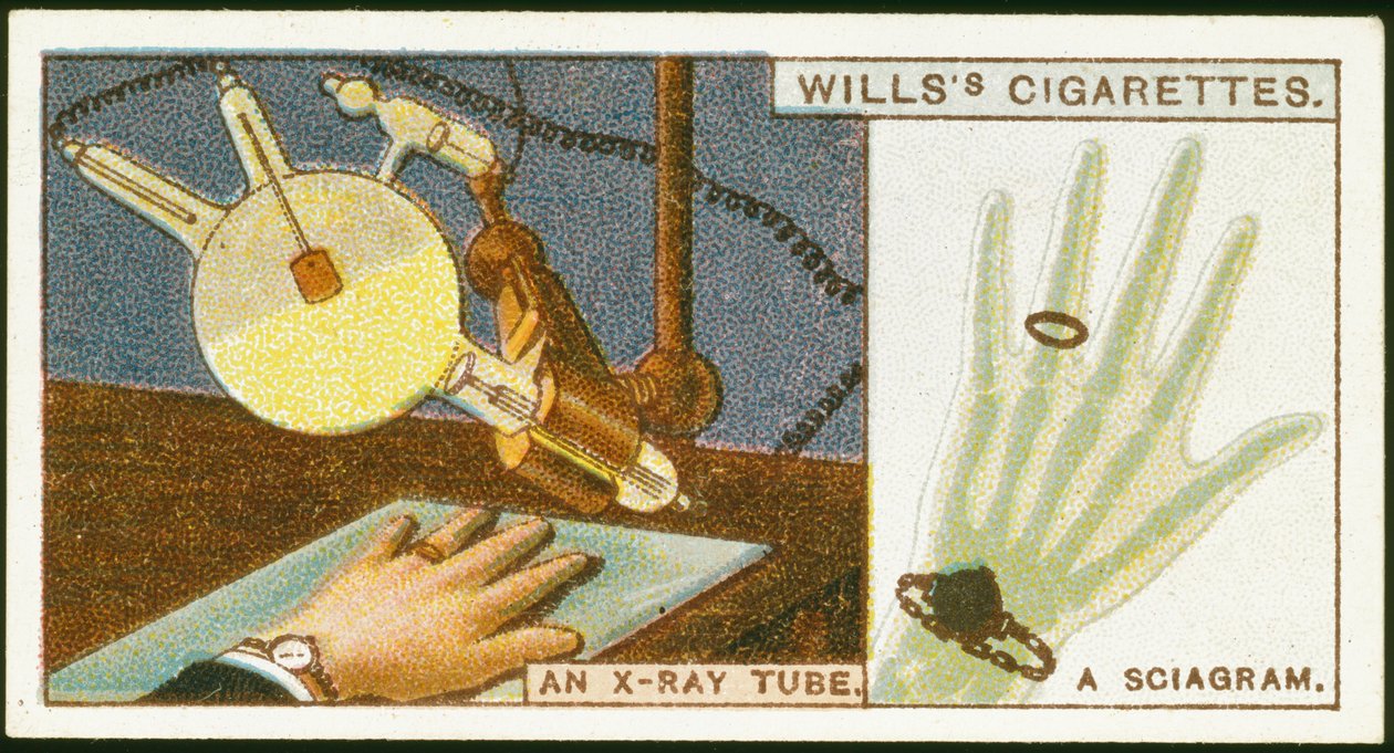 Radiografia della mano, 1924 da Unbekannt