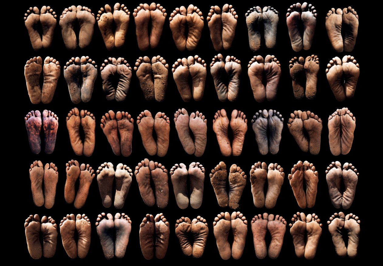 I piedi che hanno camminato verso la libertà, piedi di donne che avevano camminato da conflitti, stupri e omicidi per arrivare in sicurezza, la serie di immagini è stata vista a livello globale come un promemoria del genocidio in Darfur, Sudan, Africa (fot da Unbekannter Künstler