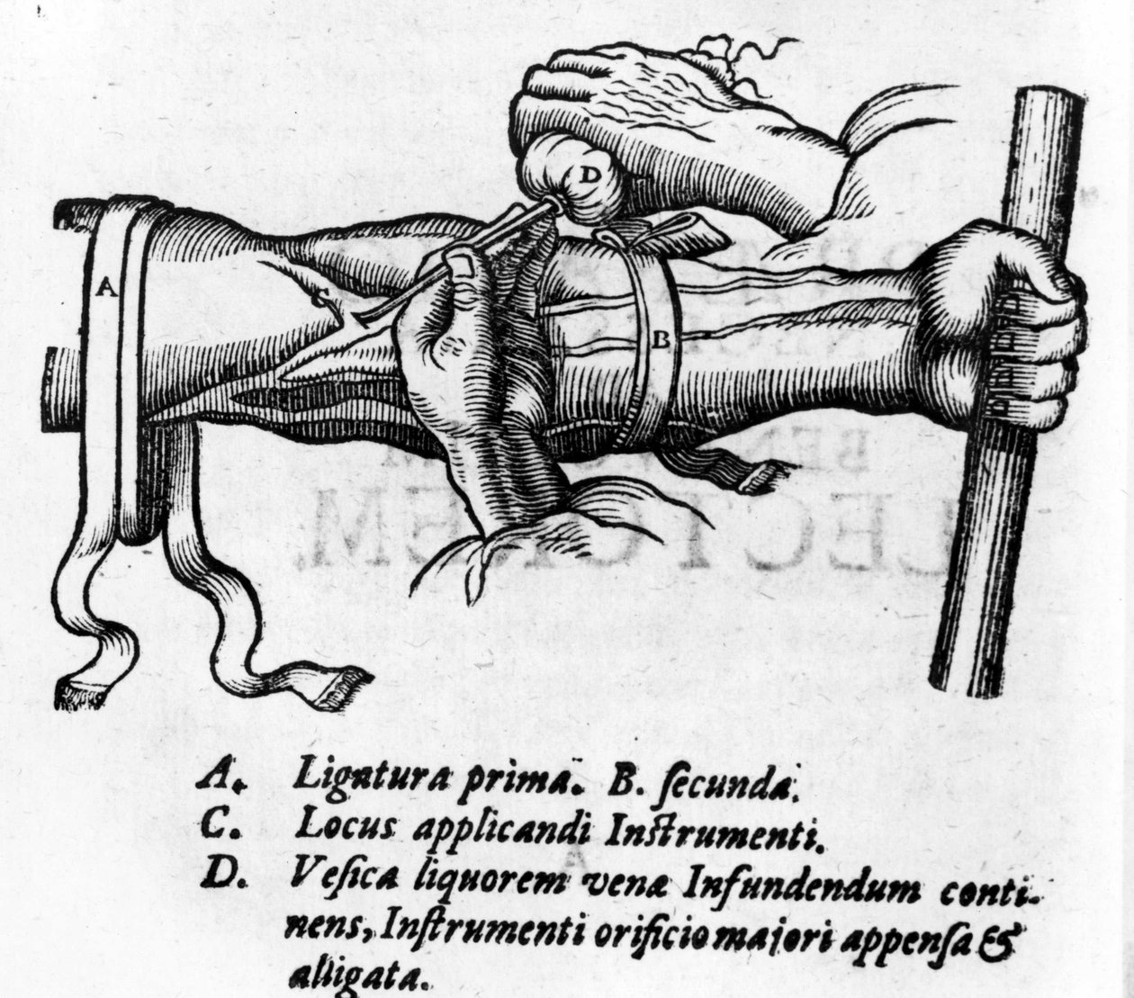 Tavola anatomica: diverse legature. Lavoro sul sistema sanguigno di William Harvey (1578-1657), medico inglese. Descrisse la circolazione del sangue nel corpo attraverso le vene da Unknown artist