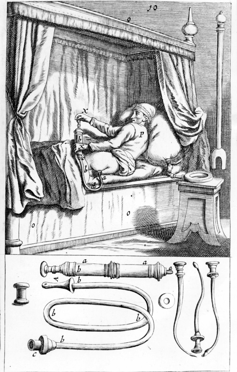 Clystère (per clisteri) di Johannes Sculptetus “Armamentarium Surgical”. Venezia 1665 da Unknown artist