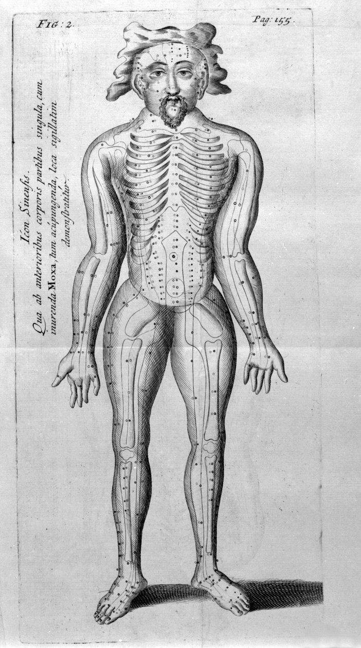 De Acupunctura di W.Ten Rhijne. Londra 1683. Primo testo occidentale sull
