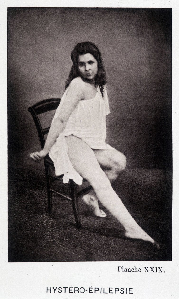 Hystero Epilepsie - Contrattura in "Iconografia fotografica della Salpêtrière: servizio del Sig. Charcot" di Paul Regnard e Bourneville da Unknown artist