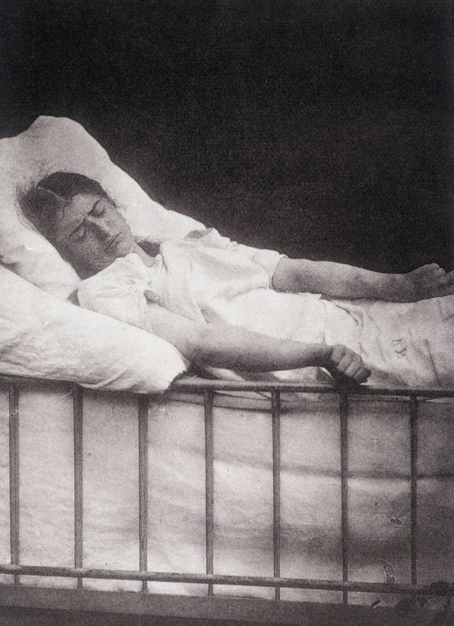 Hystero Epilepsie - Attacco di tetanismo in “Iconografia fotografica della Salpêtrière: servizio del Sig. Charcot” di Paul Regnard e Bourneville da Unknown artist