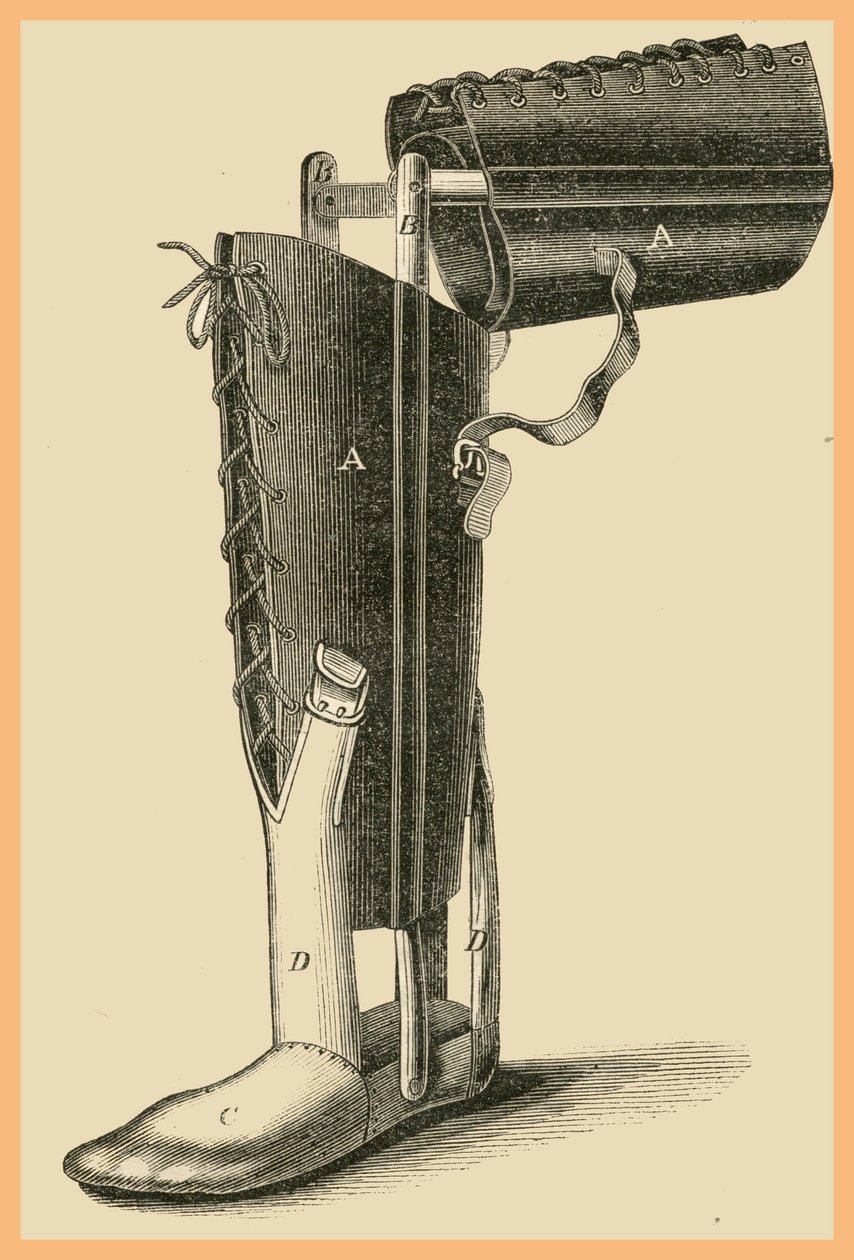 Sostituzione della gamba da Unknown Artist