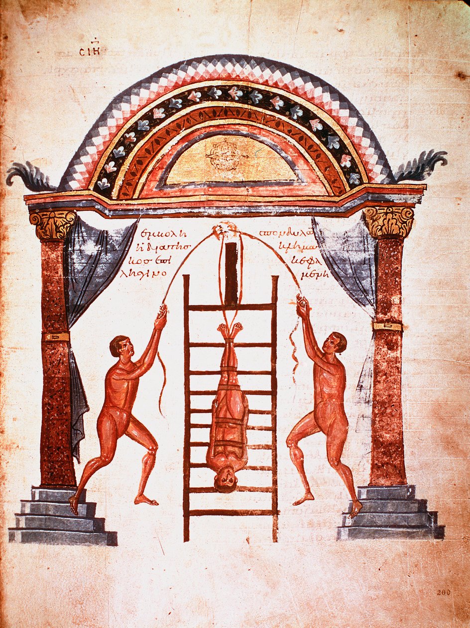 Medicina: riduzione di una spina dorsale lussata da Unknown artist