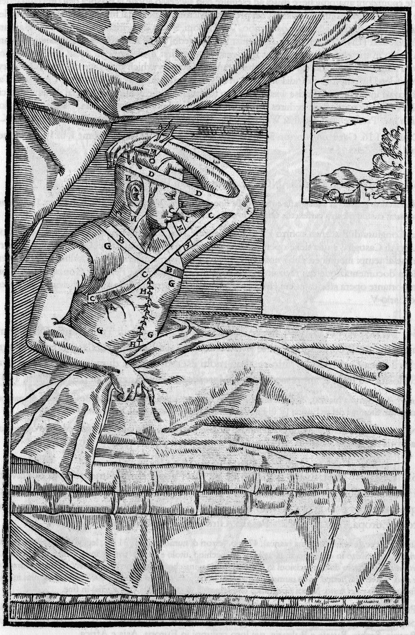 Chirurgia del naso: Chirurgia ricostruttiva del naso in "De curtorum chirurgia per insitionem". Venezia da Unknown artist