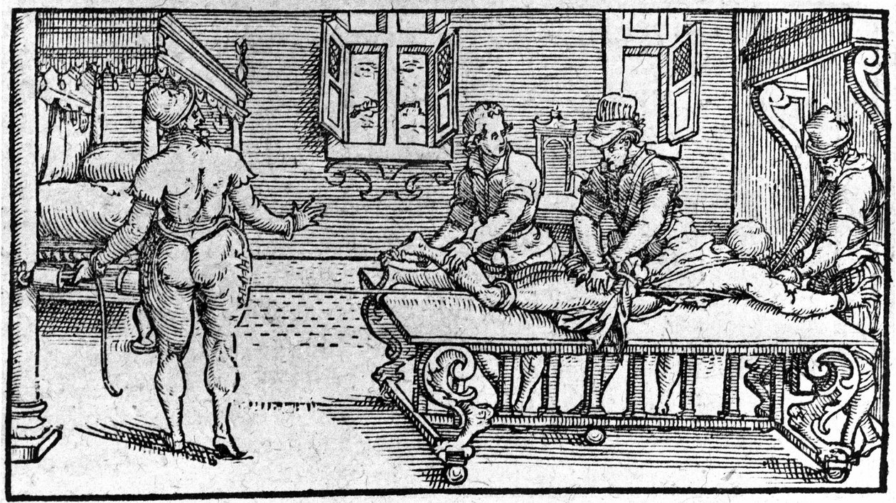 Riduzione di una lussazione, -in "Trattato Medico" di Ambroise Paré, circa 1560 da Unknown artist