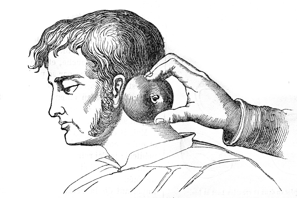 Salassi locali - applicazione di sanguisughe con una mela - incisione in "La Santé Universelle - Guide Médical des Familles" 1852 da Unknown artist