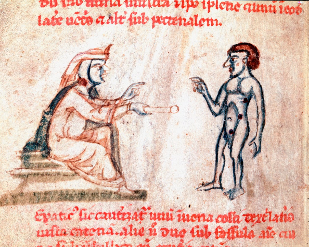 Il medico brucia il paziente nelle aree dolorose con ferri caldi, miniatura dal manoscritto De Medicina cauteriorum secundum Brunum, Rugerium et Rolthe, XIII secolo, Parigi, B.N. da Unknown artist