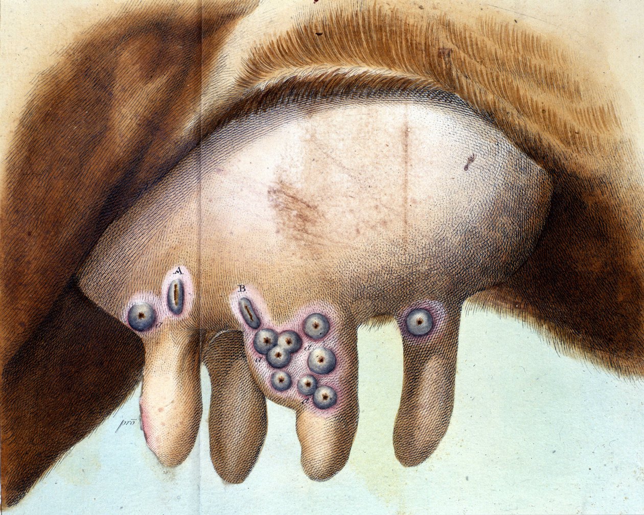 Il seno della mucca usato per inoculare il vaccino contro il vaiolo da Luigi Sacco (1769-1836) nel gennaio 1801. Tavola medica da 