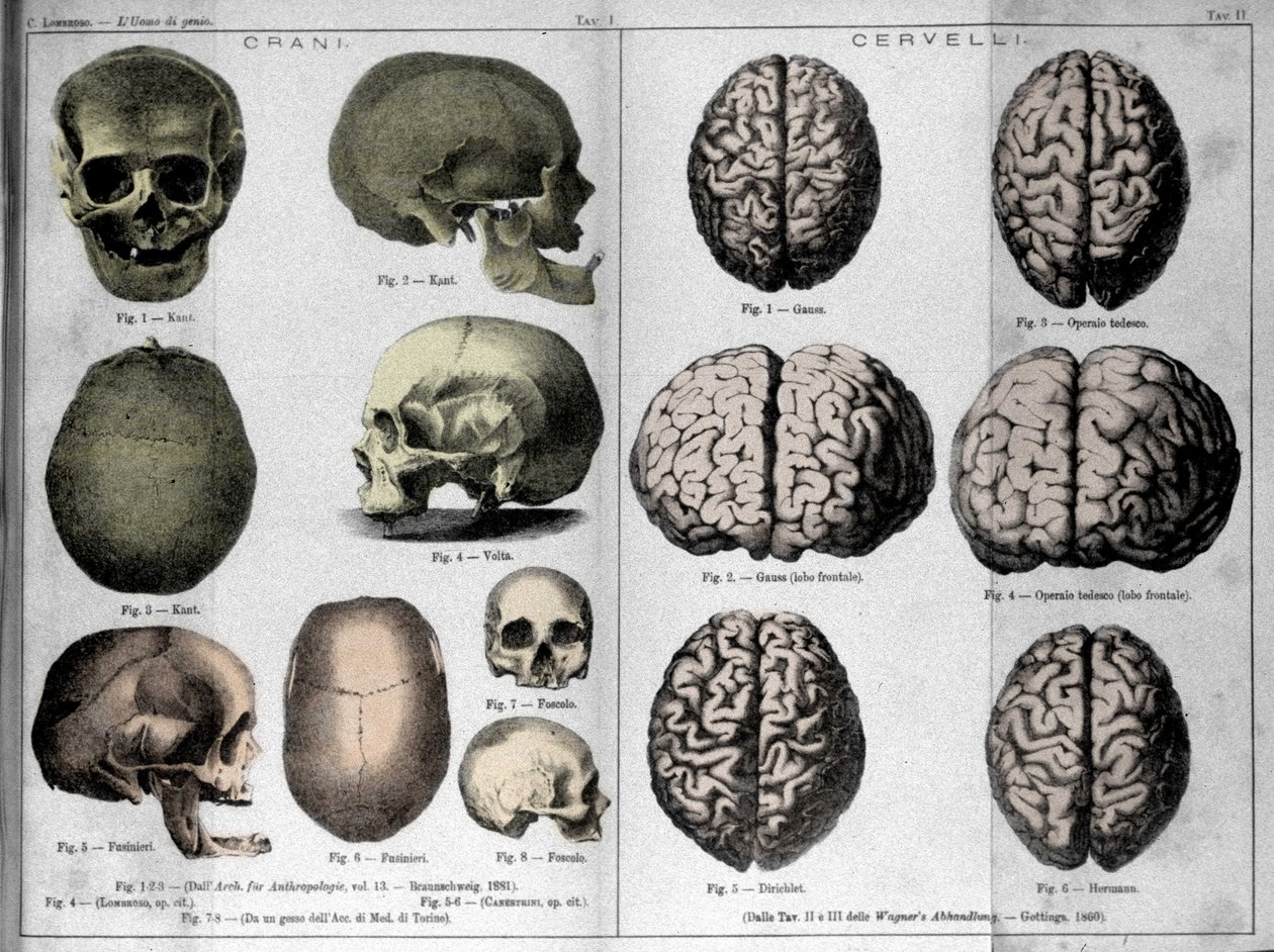 Le pelli e i cervelli degli uomini di genio. Studio di Cesare Lombroso (1835-1909), criminologo italiano in L
