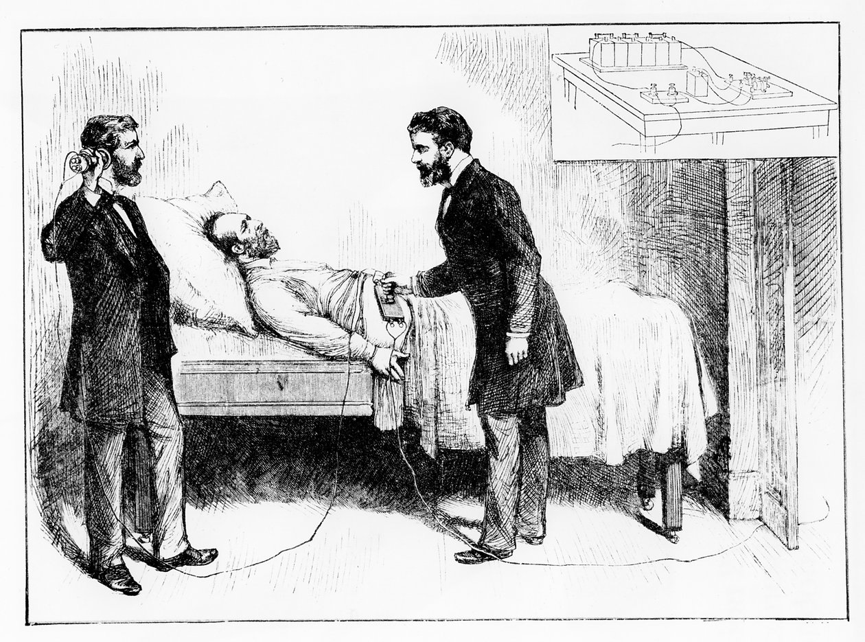 Il presidente Garfield con un proiettile non rilevato, 1881 da W. Shinkle