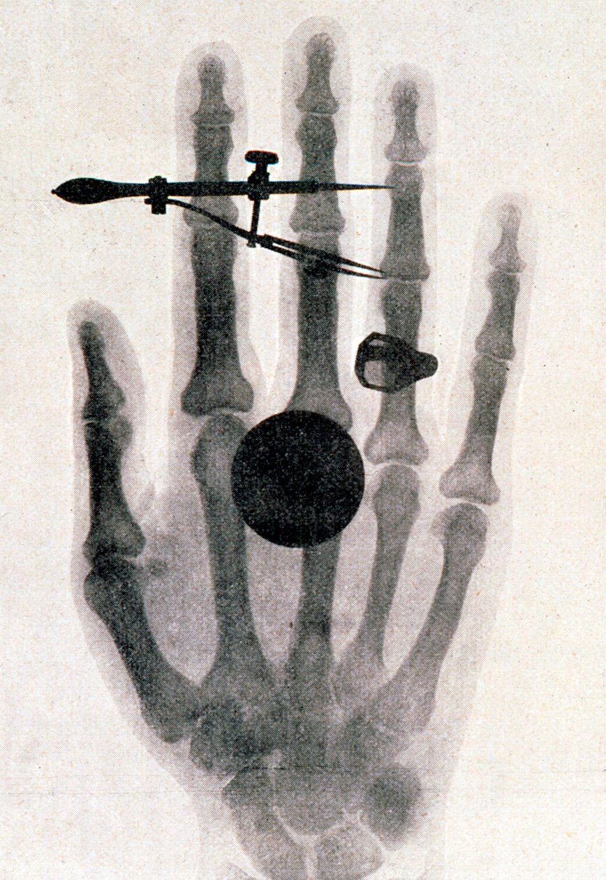Radiografia della mano della moglie di Wilhelm Roentgen, 1896 da Wilhelm Conrad Rontgen
