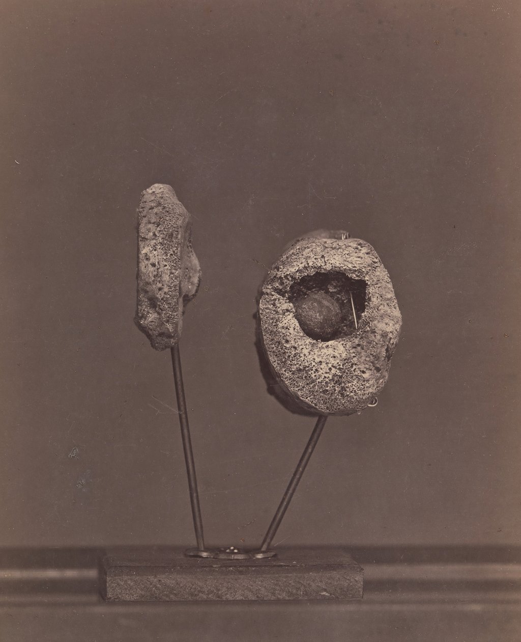 Articolazione del ginocchio escissa. Una palla di moschetto rotonda nel condilo interno del femore destro da William H. Bell