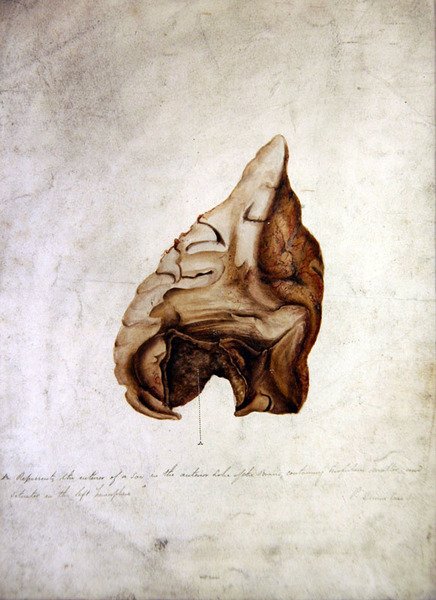 Studio del cervello I, c.1850 da William Lover