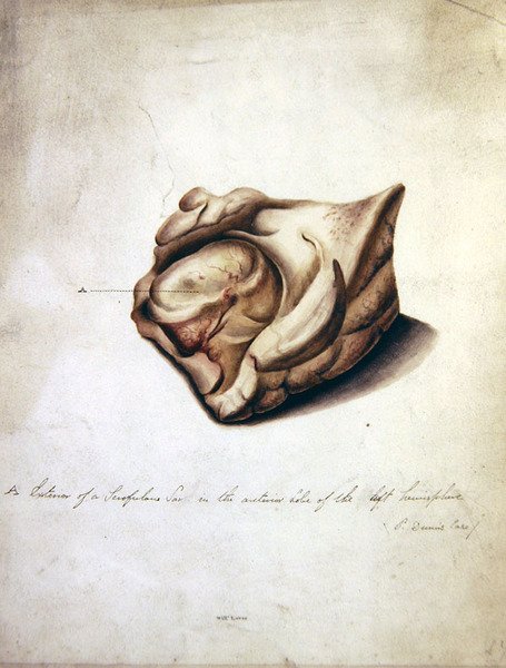 Studio del cervello II, c.1850 da William Lover