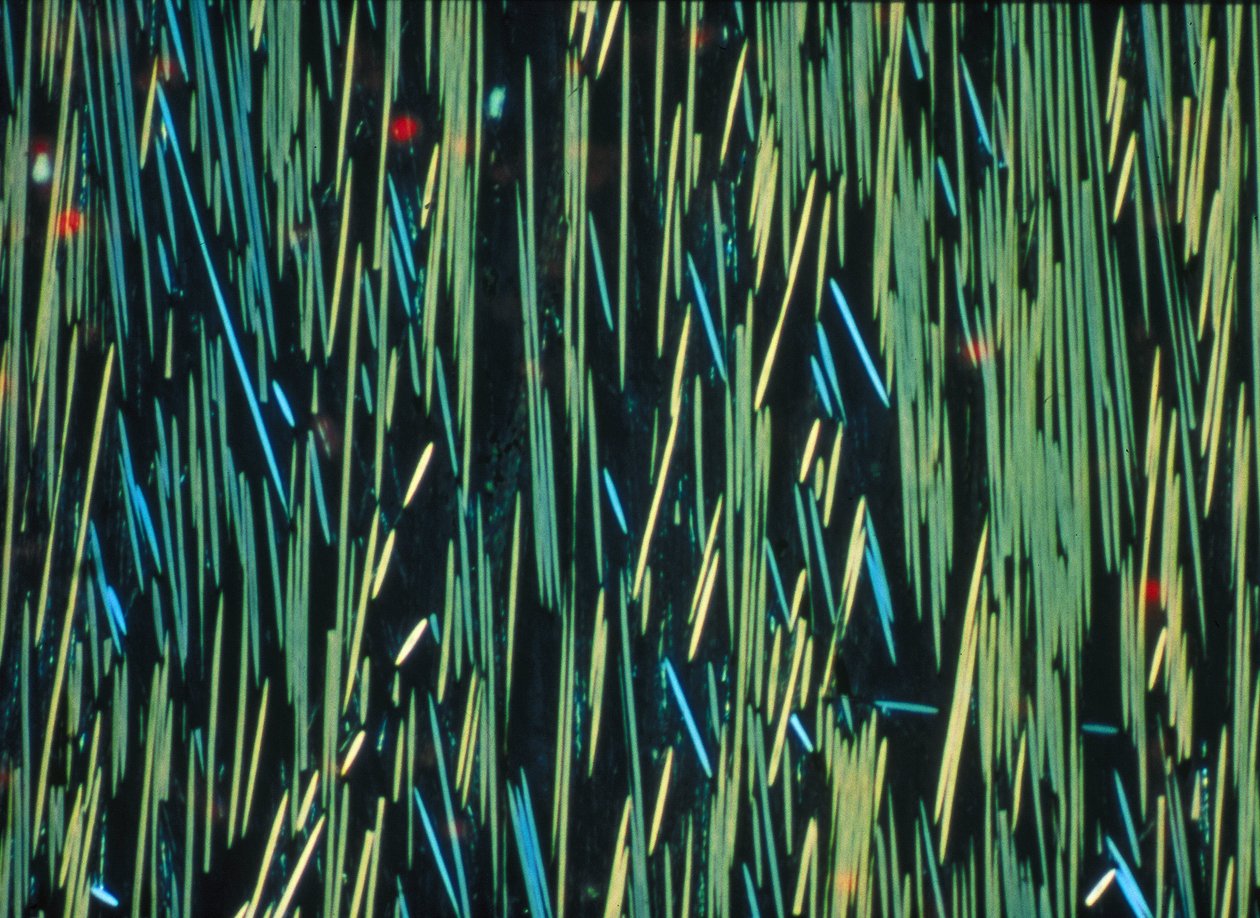 Fibra di carbonio PMC in una matrice polimerica da Frederick (attr. to) Barnard