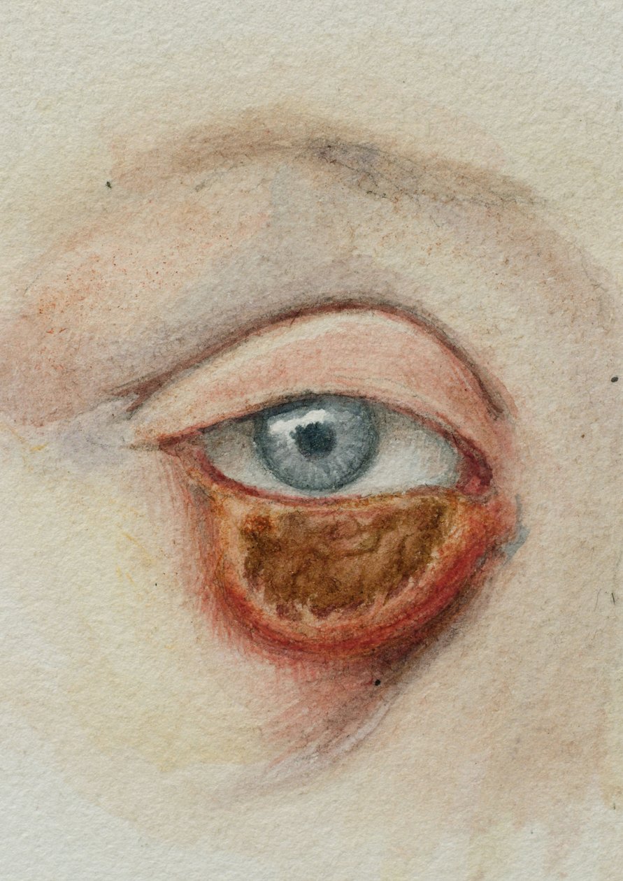 Occhi da Frederick (attr. to) Barnard