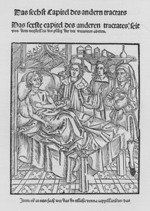 Il libro di Cirurgia di Hieronymus Brunschwig (litografia) da (after) German School