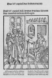 Il libro di Cirurgia di Hieronymus Brunschwig (litografia)