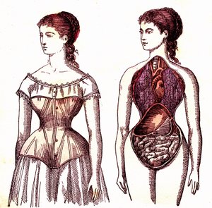 Compressione del corsetto - La vita normale e la salute di J. Rengade. Disegno di A. Demarle 1881 da Alphonse Demarle
