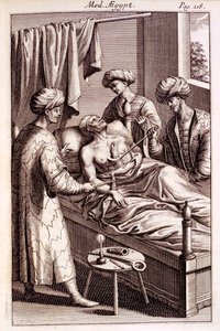 Illustrazione della moxibustione da Medicina Aegyptorum di Prospero Alpinus, 1745 da American School