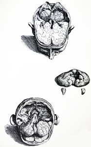 Le tavole del settimo libro del De Humani Corporis Fabrica da Andreas Vesalius