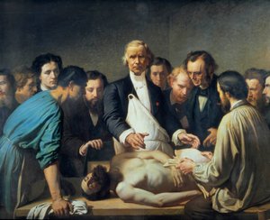 Dottor Alfred Velleau (1795-1867) alla Carità procederà a un