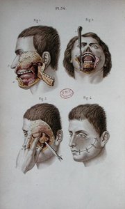 Tavola anatomica della mascella superiore