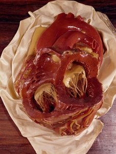 Modello di un cuore (cera)