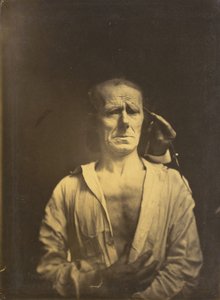 Spasmo del m. corrugatore del sopracciglio sotto luce molto forte a sinistra, un volto rilassato..., 1854-1855