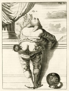 Un esempio di coppettazione, da Exercitationes Practicae circa Medendi Methodum di Frederik Dekkers, 1694 da Dutch School