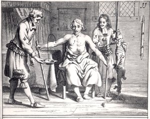 Trasfusione di sangue da un cane, da Armamentarii Chirurgici di Johannes Schultes pubblicato ad Amsterdam, 1671