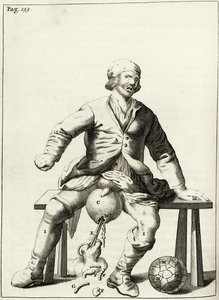 Drenaggio di liquido da un idrocele dello scroto, da Exercitationes Practicae circa Medendi Methodum di Frederik Dekkers, 1694