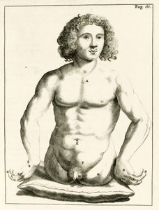 Esempio di difetti congeniti, da Exercitationes Practicae circa Medendi Methodum di Frederik Dekkers, 1694 da Dutch School