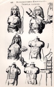 Operazione per il cancro al seno, da Armamentarii Chirurgici di Johannes Schultes pubblicato ad Amsterdam, 1672 da Dutch School